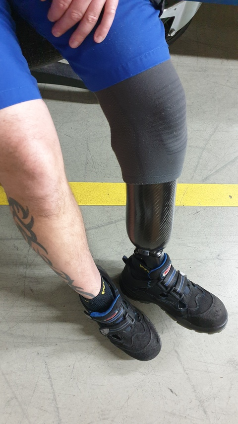 amputee_leg39 header picture leakfans.com