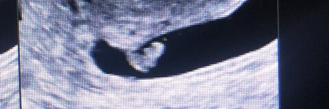 hallisomeier header picture leakfans.com